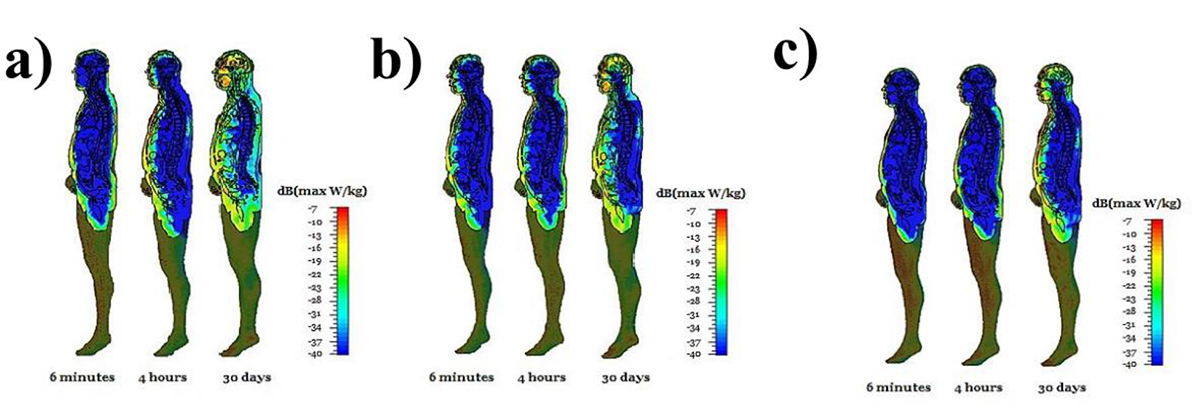 60ghz millimeter-wave radar human fall down