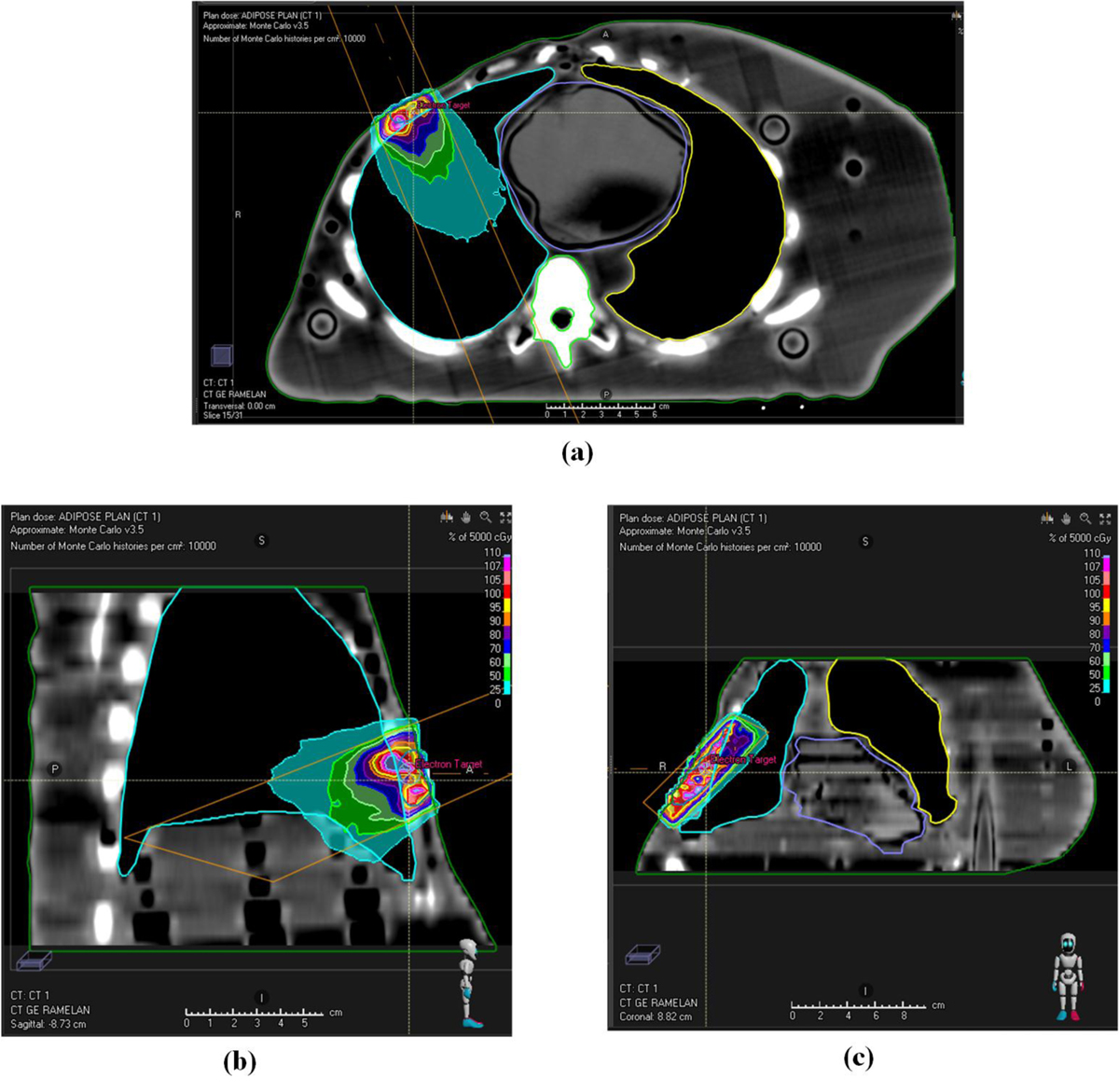 PDF] Three-Dimensional Imaging and Breast Measurements: How