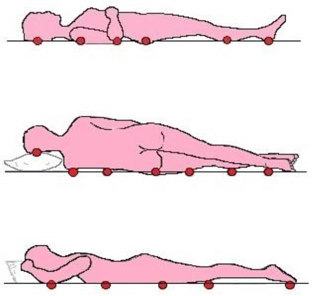 The schematic of the novel doublelayered wavy mattress, a: air (A) 