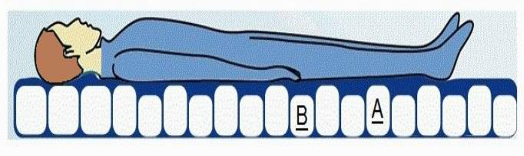 The schematic of the novel doublelayered wavy mattress, a: air (A) 